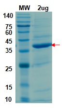 SDS-PAGE for Peptidase C16 domain of PL-Pro (746-1064); nsp3