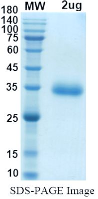 SDS-PAGE for SARS-CoV-2 RBD of Spike protein, S477N – lineage B.1.526 – NY Iota Variant