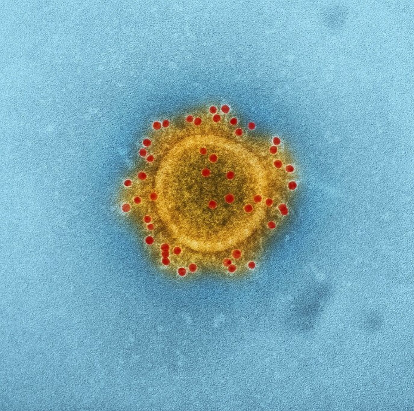 MERS-CoV