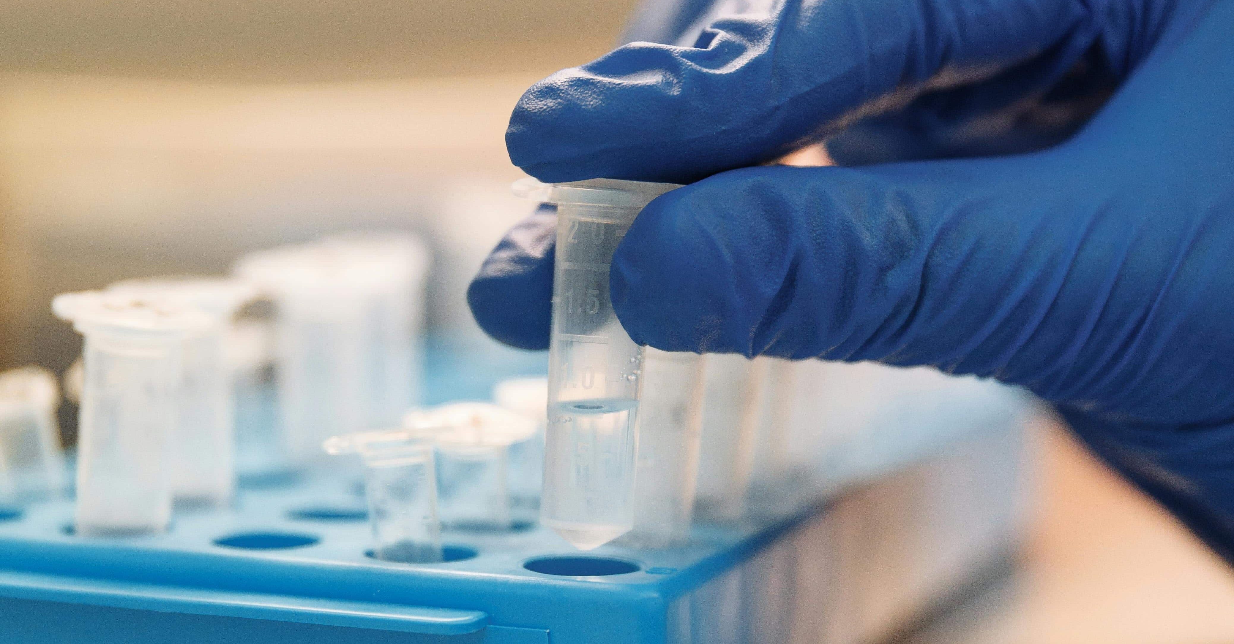 Reduce Regulatory Uncertainty with Expert-Guided Antibody Characterization services